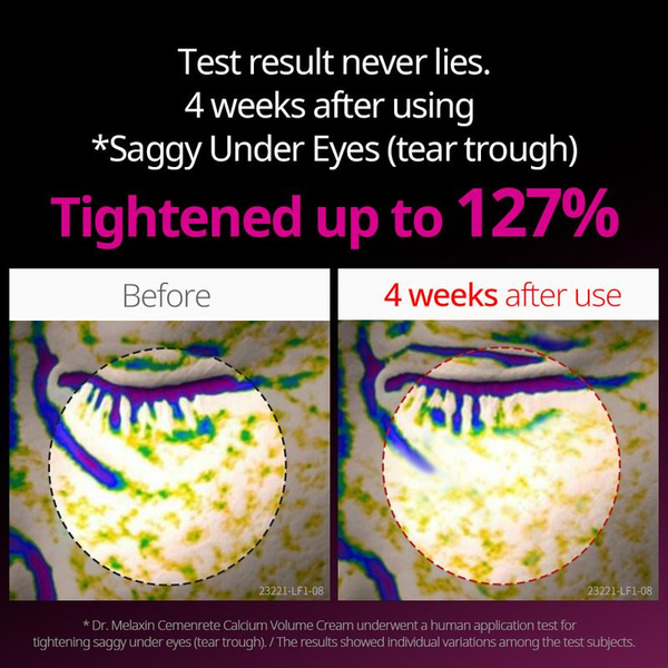 [Dr.Melaxin Official] Cemenrete Calcium Duo Cream Serum| Lifting, Anti-Aging, Elasticity, Volume | Korean Cosmetics